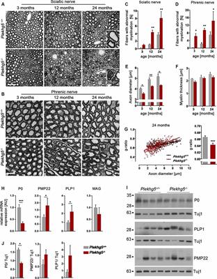 Absence of Plekhg5 Results in Myelin Infoldings Corresponding to an Impaired Schwann Cell Autophagy, and a Reduced T-Cell Infiltration Into Peripheral Nerves